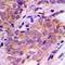 Serum/Glucocorticoid Regulated Kinase 1 antibody, LS-C352829, Lifespan Biosciences, Immunohistochemistry frozen image 