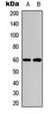 Akt antibody, LS-C358900, Lifespan Biosciences, Western Blot image 