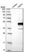 Troponin T2, Cardiac Type antibody, NBP1-88070, Novus Biologicals, Western Blot image 