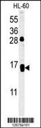 CD69 Molecule antibody, 61-918, ProSci, Western Blot image 