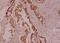 Lipase E, Hormone Sensitive Type antibody, GTX33956, GeneTex, Immunohistochemistry paraffin image 