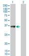 Sorting Nexin 11 antibody, H00029916-B01P, Novus Biologicals, Western Blot image 