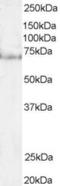 Pescadillo Ribosomal Biogenesis Factor 1 antibody, EB05994, Everest Biotech, Western Blot image 