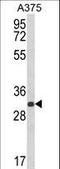 Deoxyribose-Phosphate Aldolase antibody, LS-C167366, Lifespan Biosciences, Western Blot image 