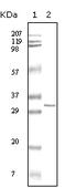 Hypoxanthine Phosphoribosyltransferase 1 antibody, 32-170, ProSci, Western Blot image 
