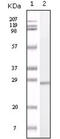 S100 Calcium Binding Protein A1 antibody, abx011492, Abbexa, Enzyme Linked Immunosorbent Assay image 