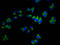 Sarcoglycan Beta antibody, LS-C681317, Lifespan Biosciences, Immunofluorescence image 