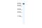 Zinc finger Y-chromosomal protein 1 antibody, A30348, Boster Biological Technology, Western Blot image 