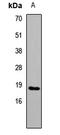 Interleukin 17F antibody, LS-C668910, Lifespan Biosciences, Western Blot image 