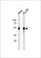 Serine/threonine-protein kinase 51PK antibody, LS-C204029, Lifespan Biosciences, Western Blot image 