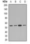 AE Binding Protein 2 antibody, LS-C482822, Lifespan Biosciences, Western Blot image 