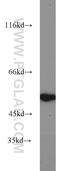 Matrix Metallopeptidase 20 antibody, 55467-1-AP, Proteintech Group, Western Blot image 