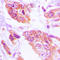 Heat Shock Protein Family H (Hsp110) Member 1 antibody, LS-C353291, Lifespan Biosciences, Immunohistochemistry paraffin image 
