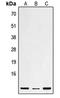 Defensin Beta 1 antibody, LS-C353722, Lifespan Biosciences, Western Blot image 