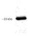 Serotonin N-acetyltransferase antibody, GTX23506, GeneTex, Western Blot image 