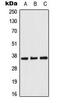 Acyl-coenzyme A thioesterase 8 antibody, MBS8229633, MyBioSource, Western Blot image 