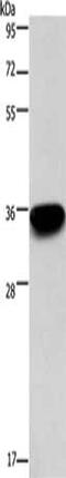 Ribose-phosphate pyrophosphokinase 1 antibody, CSB-PA568434, Cusabio, Western Blot image 