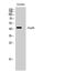 Autophagy Related 4B Cysteine Peptidase antibody, STJ91759, St John