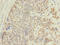 Actin Related Protein T1 antibody, A57994-100, Epigentek, Immunohistochemistry paraffin image 