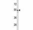 Paired Box 2 antibody, F45252-0.4ML, NSJ Bioreagents, Western Blot image 