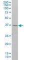 Necdin, MAGE Family Member antibody, H00004692-M07, Novus Biologicals, Western Blot image 