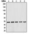 NFKB Inhibitor Beta antibody, orb214313, Biorbyt, Western Blot image 