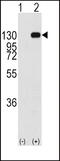 Fibroblast Growth Factor Receptor 1 antibody, 63-080, ProSci, Western Blot image 