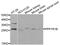 Protein Phosphatase 1 Regulatory Inhibitor Subunit 1B antibody, abx006723, Abbexa, Western Blot image 