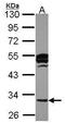Cathepsin K antibody, GTX105671, GeneTex, Western Blot image 