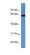 Microtubule Associated Protein 6 antibody, NBP1-91503, Novus Biologicals, Western Blot image 