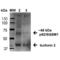 Sequestosome 1 antibody, LS-C774095, Lifespan Biosciences, Western Blot image 