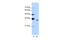 Peptidylprolyl Isomerase E antibody, 29-364, ProSci, Western Blot image 