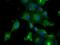 Prolactin antibody, NBP2-02142, Novus Biologicals, Immunofluorescence image 
