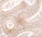 Mitochondrial Transcription Termination Factor 2 antibody, A12326, Boster Biological Technology, Immunohistochemistry paraffin image 