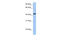 IGF Like Family Receptor 1 antibody, 26-453, ProSci, Enzyme Linked Immunosorbent Assay image 