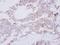 GRAP2 antibody, LS-C186400, Lifespan Biosciences, Immunohistochemistry paraffin image 