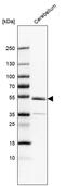 Zinc Finger Protein 692 antibody, PA5-63704, Invitrogen Antibodies, Western Blot image 
