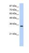 Muscleblind Like Splicing Regulator 1 antibody, NBP1-80488, Novus Biologicals, Western Blot image 