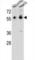 Tripartite Motif Containing 64 antibody, abx027324, Abbexa, Western Blot image 