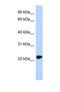 Ubiquitin C-Terminal Hydrolase L3 antibody, NBP1-55316, Novus Biologicals, Western Blot image 