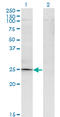 TGFB Induced Factor Homeobox 2 antibody, LS-C139518, Lifespan Biosciences, Western Blot image 
