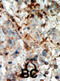Cyclin Dependent Kinase Inhibitor 3 antibody, abx033454, Abbexa, Immunohistochemistry paraffin image 