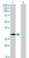 Polypeptide N-Acetylgalactosaminyltransferase 12 antibody, H00079695-B01P, Novus Biologicals, Western Blot image 