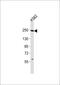 SWI/SNF Related, Matrix Associated, Actin Dependent Regulator Of Chromatin, Subfamily A, Member 4 antibody, M00223-2, Boster Biological Technology, Western Blot image 