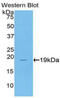 Colony Stimulating Factor 3 antibody, abx104104, Abbexa, Western Blot image 