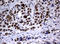 Nibrin antibody, LS-C175560, Lifespan Biosciences, Immunohistochemistry paraffin image 