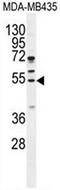 Cycb antibody, AP50806PU-N, Origene, Western Blot image 