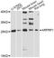 ADP Ribosylation Factor Related Protein 1 antibody, A14311, ABclonal Technology, Western Blot image 