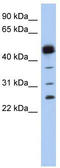Hematopoietic Prostaglandin D Synthase antibody, TA346774, Origene, Western Blot image 