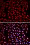 Retinoic Acid Receptor Alpha antibody, orb129732, Biorbyt, Immunofluorescence image 